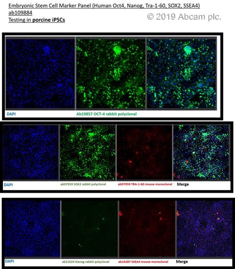 Embryonic Stem Cell Marker组合human Oct4，nanog，tra 1 60 R，sox2，ssea4