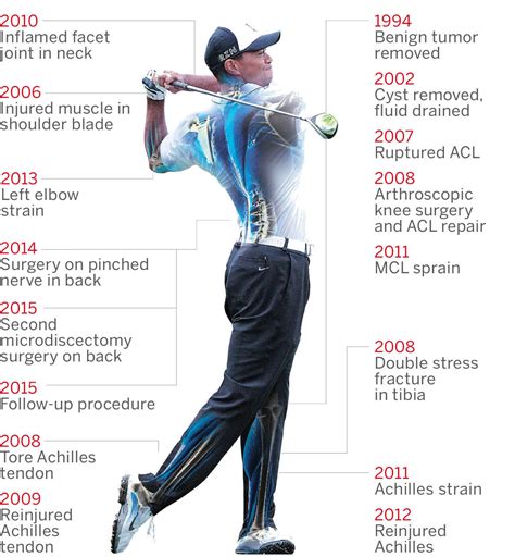 Tiger Woods' injury timeline - ABC News