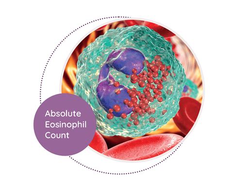 Absolute Eosinophil Count - MediScan Lab