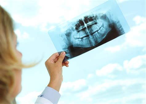 Why Are Dental X Rays Important