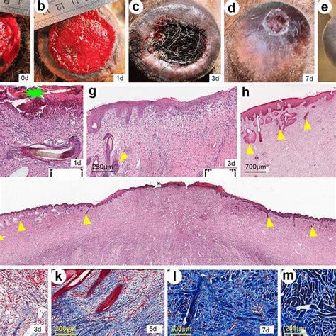 Schematic Diagram To Depict The Course Of Regenerative Wound Healing