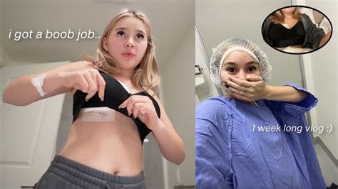 I Got A Breast Augmentation Surgery 1 Week Recovery Vlog Journey