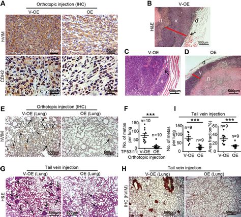 Tp I Overexpression Reduces Mda Mb Cells Metastasis In Vivo