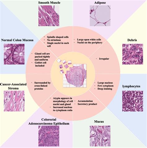 Figure 3 From Interpretable Inference And Classification Of Tissue