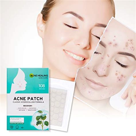 Plus Acne Patch Invisible Concealer And Hydrocolloid Pimple Patches For Face Fast And Perfect