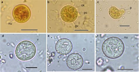 Cysts And Trophozoites Of Entamoeba Found In Populations From Download Scientific Diagram