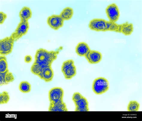 Varizella Zoster Virionen Fotos Und Bildmaterial In Hoher Aufl Sung