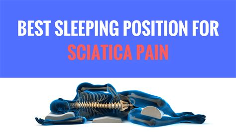 Best Position To Sleep With Sciatica Pain