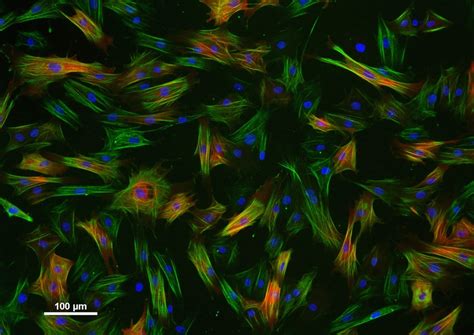 Vascular Bypass Grafting: A Biomimetic Engineering Approach