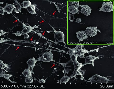 Picture Of Netosis Obtained With A Scanning Electron Microscope Note