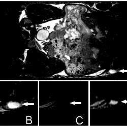 MR Images Of A Nude Mouse Brachial Lymph Node Acquired With Different Pulse Sequences