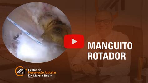 Cirurgia Ruptura Do Manguito Rotador Centro De Preserva O Articular