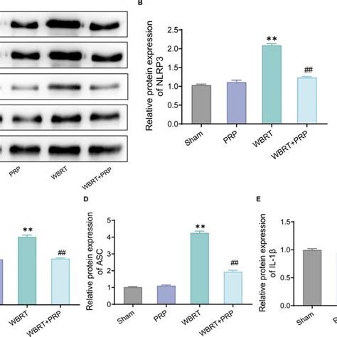 Platelet Rich Plasma Inhibits The Activation Of Nlrp Inflammasomes In