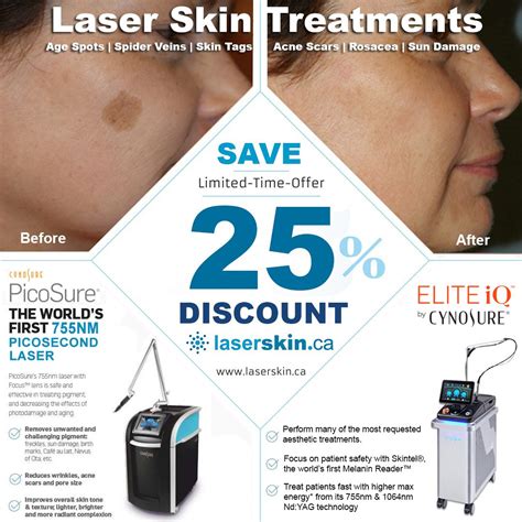 SALE on Port Wine Stain Laser Treatment | LASERSKIN.CA