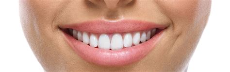 Zahn Gemeinschaftspraxis Veneers Kronen Brücken