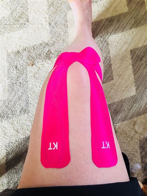 How To Tape Arthritic Knee With Kt Tape At Patricia Timmons Blog