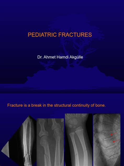 Pediatric Fractures | PDF | Bone | Surgical Specialties