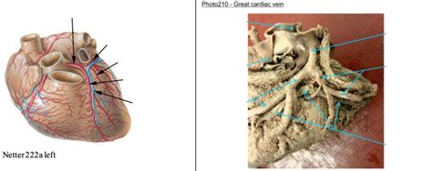 Great Cardiac Vein Diagram | Quizlet