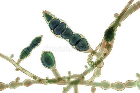 Microsporum Audouinii Stock Illustrations – 61 Microsporum Audouinii ...