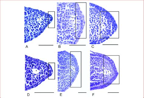 The Apical Ectoderm In Anuran Limb Buds Parasagittal Sections Of Fore