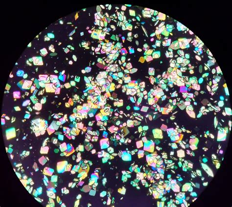 uric acid crystals polarized