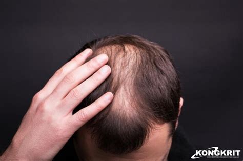 Tips Merawat Rambut Agar Tidak Mudah Rontok Kenali Penyebabnya