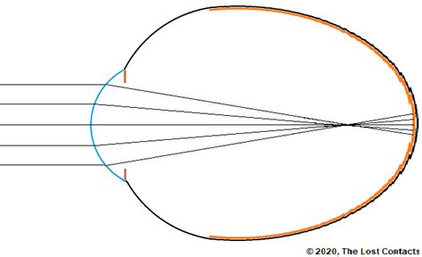 The Optics of Vision - Lesson 6: Emmetropia & Myopia - The Lost Contacts