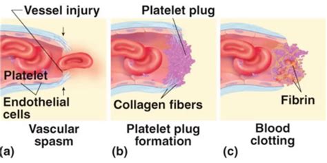Haemostasis and electrosurgery Flashcards | Quizlet 