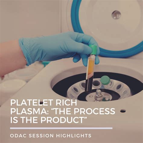 Platelet Rich Plasma The Process Is The Product Next Steps In