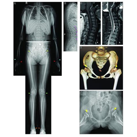 X Ray Ct Of The Pelvis And Cervical Mri Examination Ab