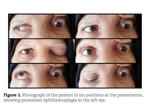 Photograph of the patient in six positions at the presentation, showing ...