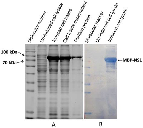 Sds Page And Western Blotting Analysis Of Jev Ns1expression A