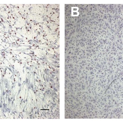 Brdu Assay Of Human Corneal Endothelial Cells Cultured On The