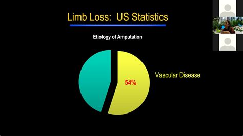 Lower Extremity Amputation And Function By Lisa Pascual Md Youtube