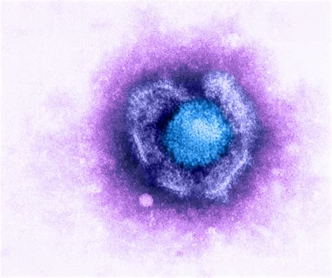 Herpes Simplex Virus Photograph By Kwangshin Kim Pixels