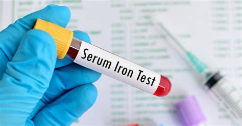 Iron Serum Test Purpose Procedure Results Healthians Blog