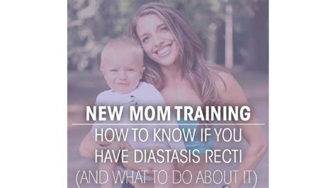 How To Know If You Have Diastasis Recti