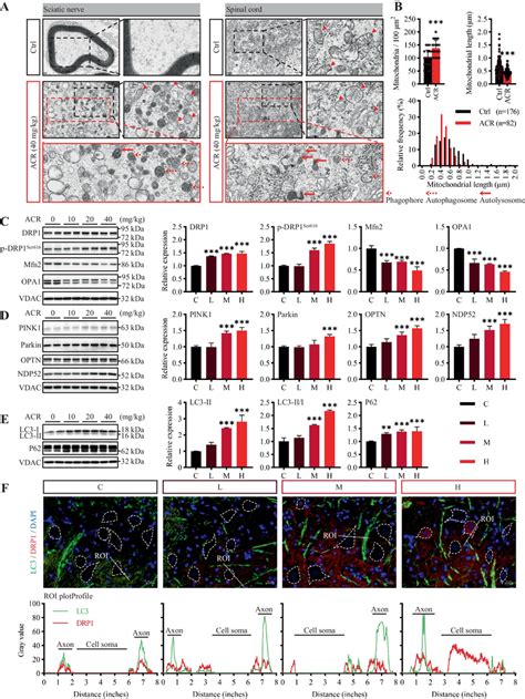 Mitochondrial dynamics are disturbed, and mitophagy-related proteins ... 