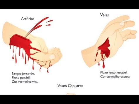 É Normal Parar De Sangrar No Resguardo E Depois Voltar - Como parar um sangramento em menos de 1 minuto com este simples truque ...