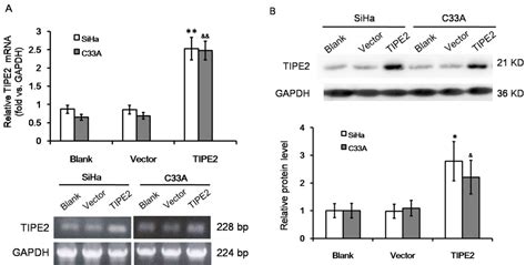 Immune Negative Regulator Tipe Inhibits Cervical Squamous Cancer