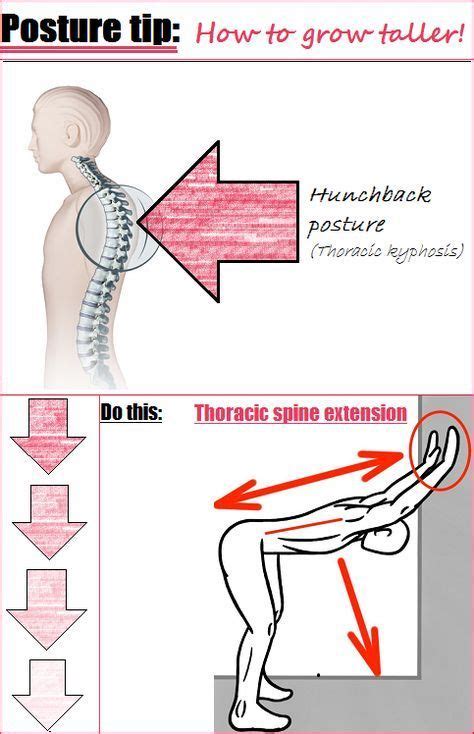 How To Fix Hunchback Posture - Posture Direct | Posture exercises ...