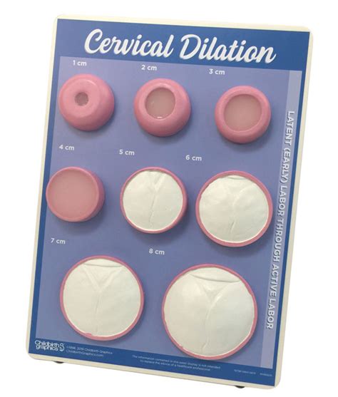 Cervical Dilation Model