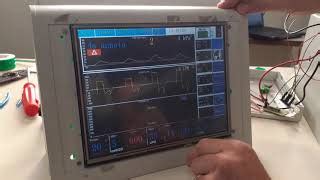 Prot Tipo De Ventilador Pulmonar Do Br Recebe Investimentos Canaltech