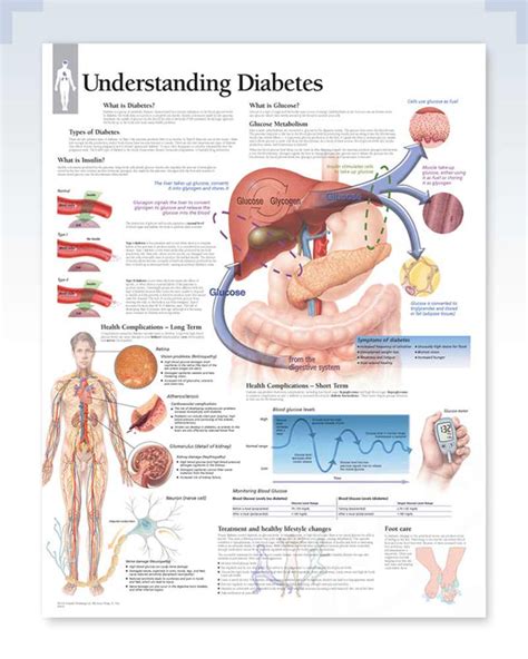 Laminated Type 2 Diabetes Anatomy Posters