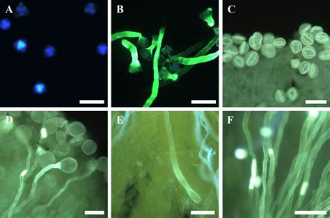 Pollen Germination And Pollen Tube Growth In Japanese Plum Pollen