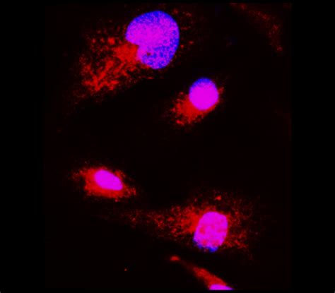 Neuroinflammation Antibody Panel Irap Ireal Biotechnology Inc