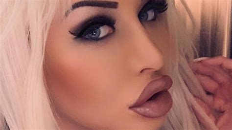 Model Has 50k Plastic Surgery Boob Jobs To Look Like Barbie Doll Photo