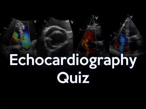 Echocardiography Quiz : r/usmle 