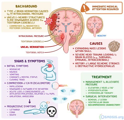 Uncal Herniation: What Is It, Causes, and More | Osmosis