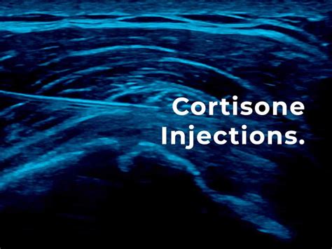 Cortisone Injections Patient Guide Melbourne Radiology